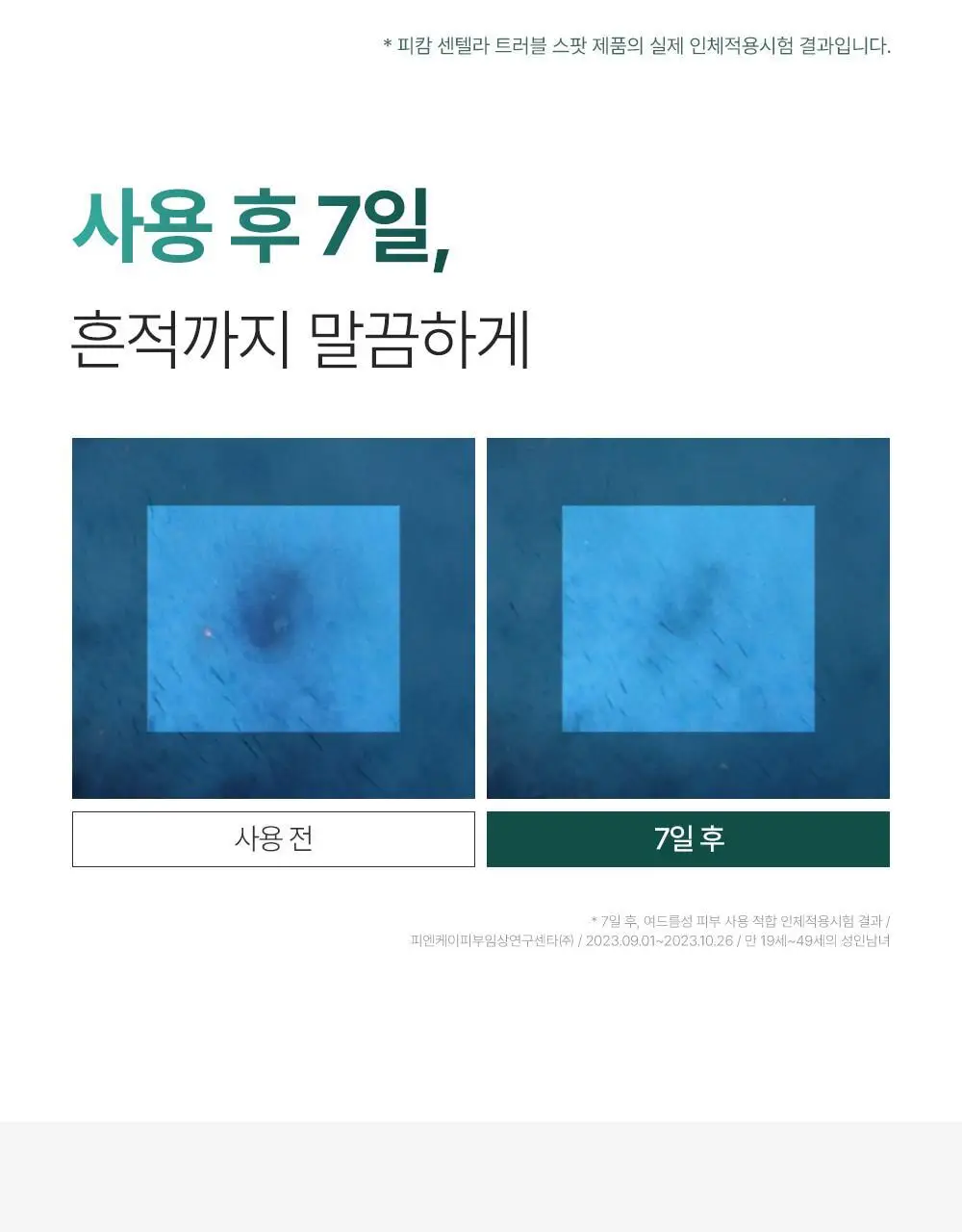 [트러블부위 진정케어] 피캄 센텔라 트러블 스팟 15ml 상세페이지 13